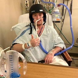 traumatic-brain-injury